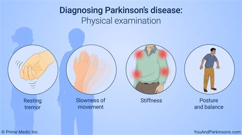 Slide Show - Diagnosis of Parkinson’s Disease