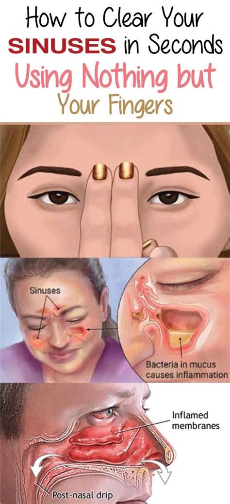 Blocked sinuses are a common problem for people of all ages. It is caused by numerous different ...