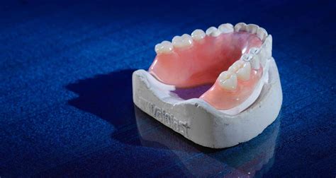 What are flexible dentures? - Algodones Dentists Guide