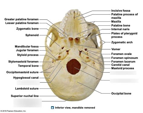 cranium - occipital bone Diagram | Quizlet