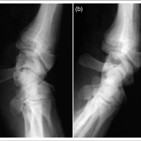 (PDF) Are Humans Descended from a Knuckle-Walking Ancestor?