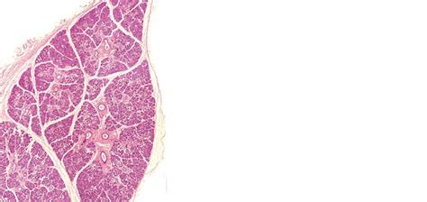 Strategies for Addressing Sialorrhea - Dimensions of Dental Hygiene