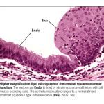 Higher Magnification Light Micrograph of the Cervical Squamocolumnar Junction