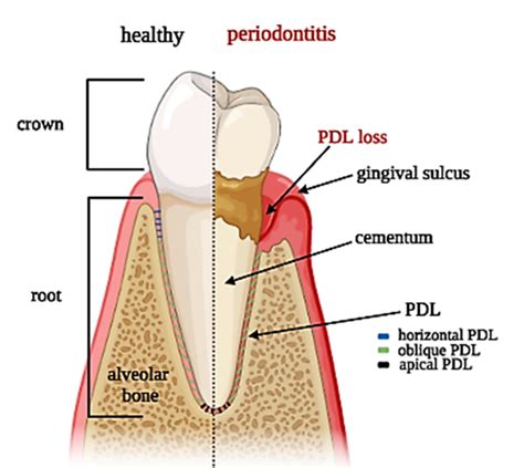 Periodontal Ligament Structure And Function Dental News, 41% OFF