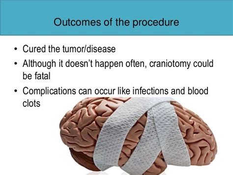 Craniotomy