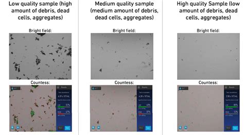 What can I do if my single cell/ nuclei suspension contains a high amount of debris? – 10X Genomics