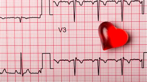 Simple Guidance For You In Home Healthcare [Can An Ekg Detect A Heart ...