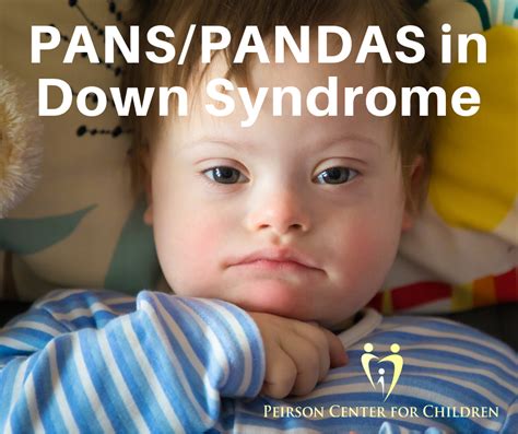 PANS/PANDAS in Down Syndrome