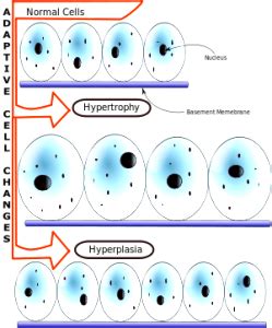 Hyperplasia_vs_Hypertrophy-249×300 (1) – WorldHGH.com