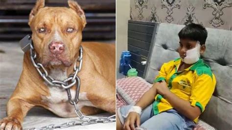 Ghaziabad: Pitbull dog bites 10-year-old boy's face and ears; victim ...