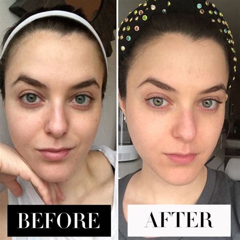 I Used Only Kylie Skin Products For a Whole Week. Here's My Honest Review. - Harper's BAZAAR ...