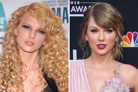 Taylor Swift Plastic Surgery Mystery Solved!