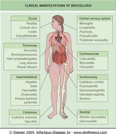 Brucellosis