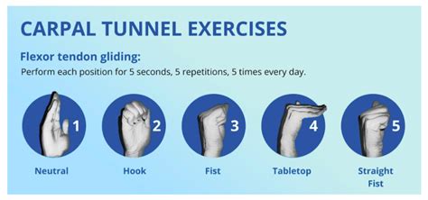 Exercises for Carpal Tunnel Pain | Core Orthopedics