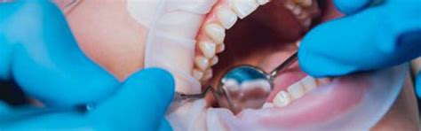 Root Canal Aftercare: What To Do And What Not To Do | Dental Cosmetic Turkey