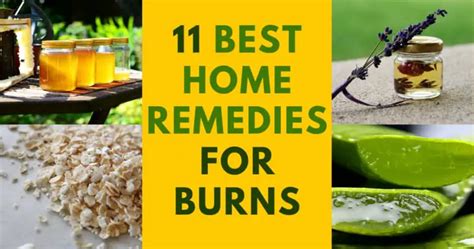 11 Best Home Remedies for Burns - SHTFPreparedness