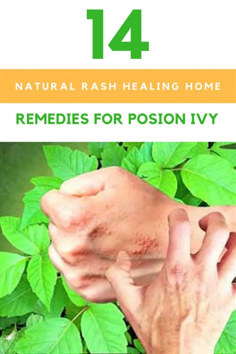 14 Natural Rash Healing Home Remedies For Poison Ivy