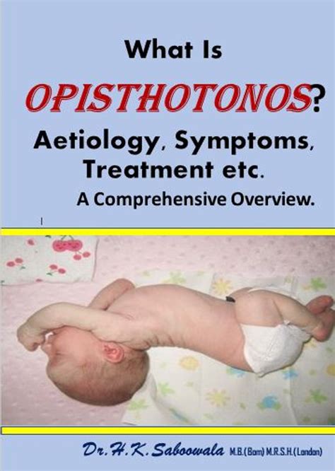 What Is Opisthotonos? Causes, Symptoms, Treatment etc. A Comprehensive ...