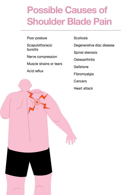 Shoulder Blade Pain Causes Treatment And Prevention | Porn Sex Picture