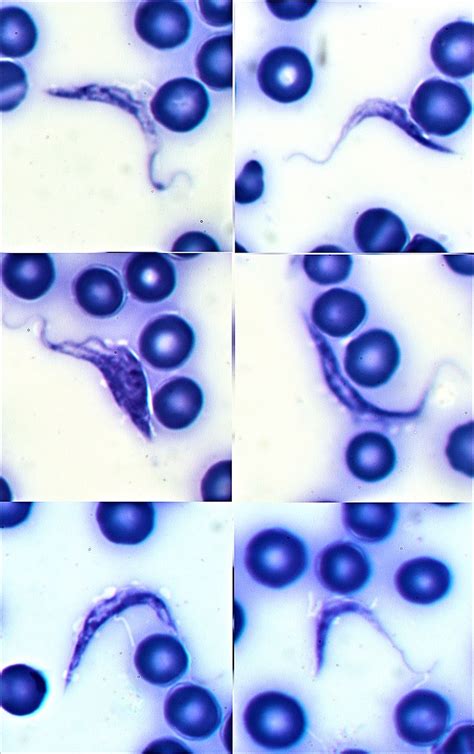 Trypanosoma cruzi - Wikipedia