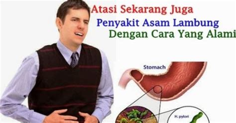 Kenali Gejala dan Makanan Penyebab Asam Lambung, Musnahkan Bahayanya ...