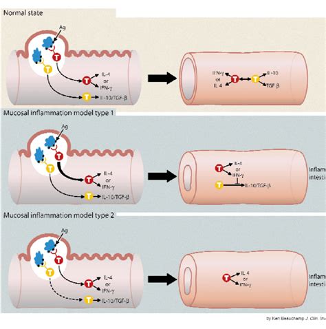 Routes to mucosal inflammation. Antigens stimulating the mucosal immune ...