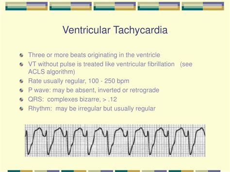 Ventricular Tachycardia Causes Symptoms And Diagnosis - vrogue.co