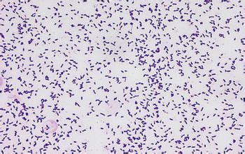 Streptococcus mutans