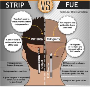 FUT vs FUE Method – The Differences Between the Two Ways to Treat Hair Loss