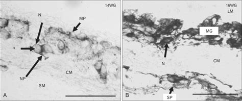 Development of myenteric plexus in human foetuses: a quantitative study ...