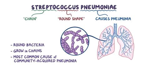 Streptococcus pneumoniae - Osmosis