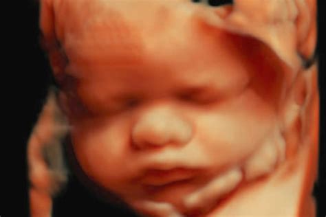 5D ultrasounds. | BabyCenter