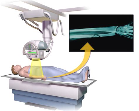 Future Portable X-Ray Imaging