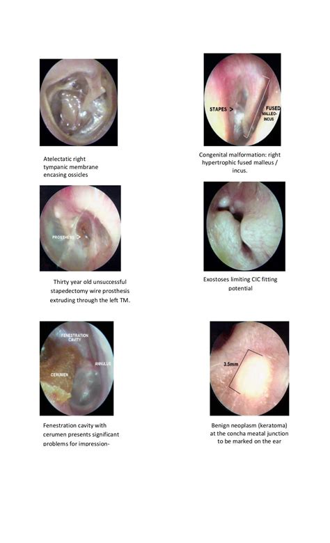 Tympanic membrane dr. fadil