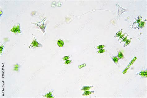 Freshwater aquatic plankton under microscope view. Stock Photo | Adobe ...