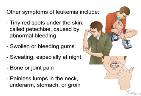 Petechiae Leukemia Symptoms