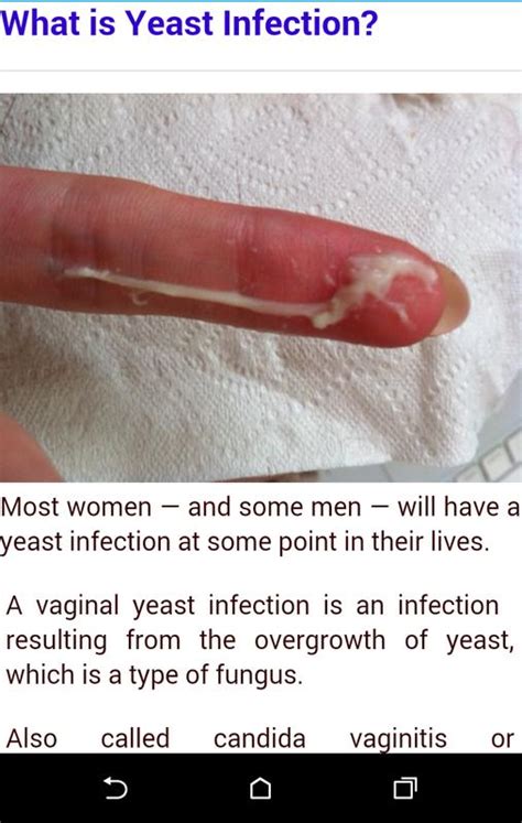 Yeast Infection Cure Yeast Infection In Men Yeast