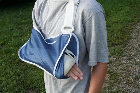 Hand fracture: symptoms, diagnosis and treatment features | Health 2023