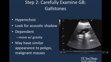 Biliary Tree Anatomy Ultrasound