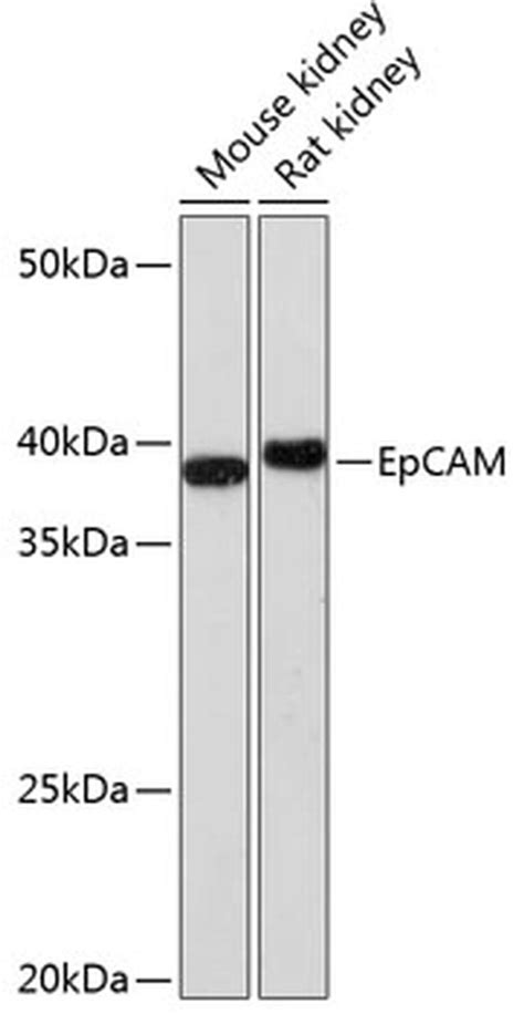 EpCAM Recombinant Monoclonal Antibody (ARC0521) (MA5-35065)