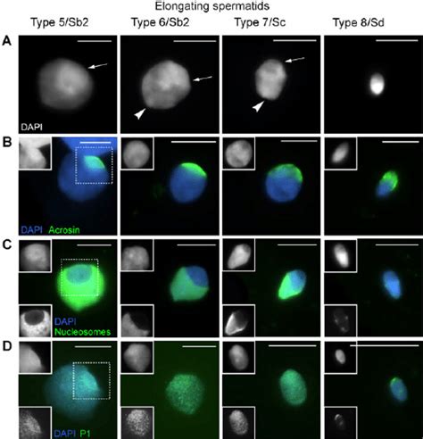 Elongating spermatid nuclei in succeeding steps of human... | Download ...