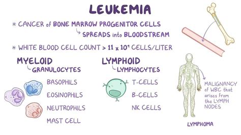 Hairy Cell Leukemia: What Is It, How Common Is It, and More | Osmosis