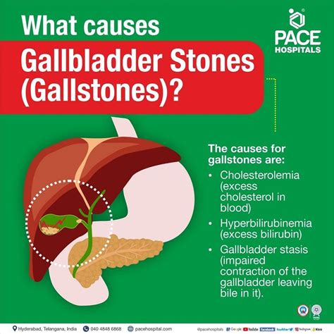 Gallstones, Gallbladder Stones – Symptoms, Causes, Complications