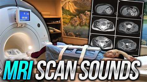 MRI Sounds Inside Scan Room - Pelvic MRI with Contrast ASMR - YouTube