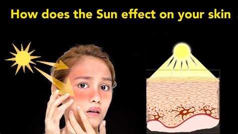 Sun effect on skin I How does the sun effect on your skin I Effect of sun on skin - YouTube