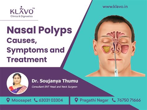 Nasal Polyps Symptoms Causes Diagnosis Treatment Only - vrogue.co