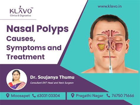 Nasal Polyps Treatment in Hyderabad | Klavo Clinics