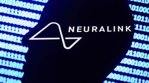 Elon Musk’s Neuralink Could Be Trialed In Humans In 2023. Here’s What ...