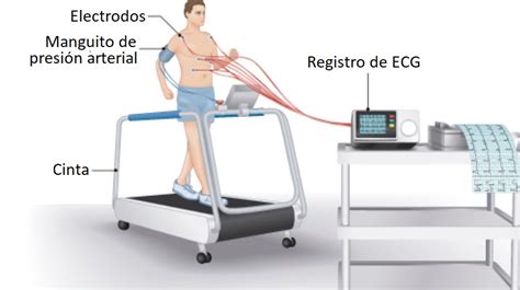 Técnicas y procedimientos de Enfermería: ELECTROCARDIOGRAMA (II): PRUEBA DE ESFUERZO