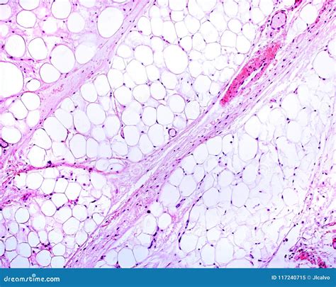 Adipose tissue stock image. Image of eosin, micrograph - 117240715